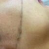 شفرات ترينا للوجه